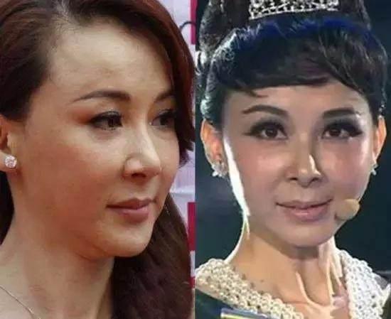 整容前后差别大的女明星，重塑美丽还是重塑自我？，整容前后差异显著的女明星，重塑美丽还是自我探索之旅？