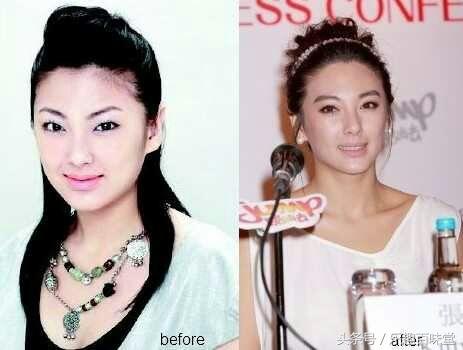 整容前后差别大的女明星，重塑美丽还是重塑自我？，整容前后差异显著的女明星，重塑美丽还是自我探索之旅？